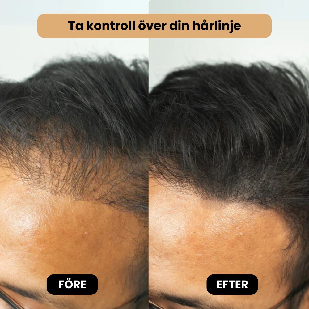Manfix - Ökat självförtroende med tjockare hår på sekunder